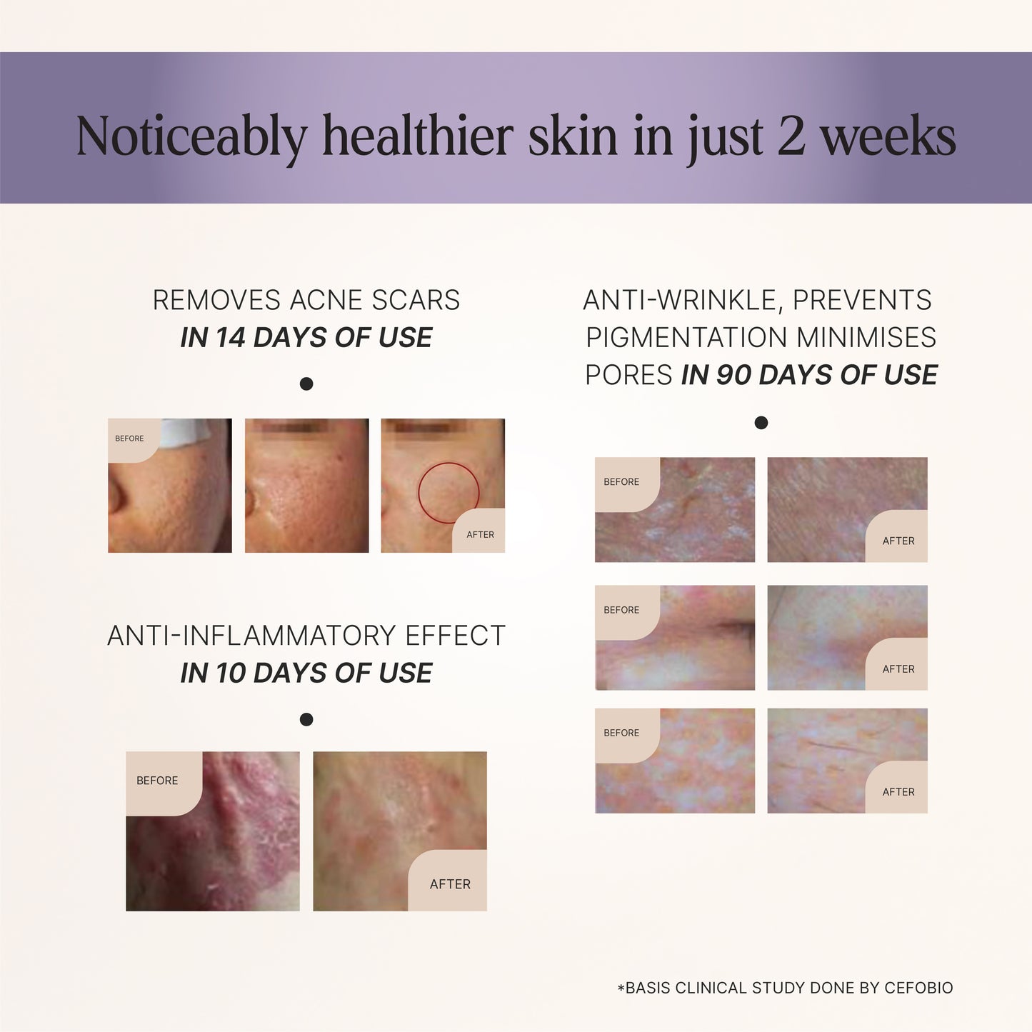 skin repair cream