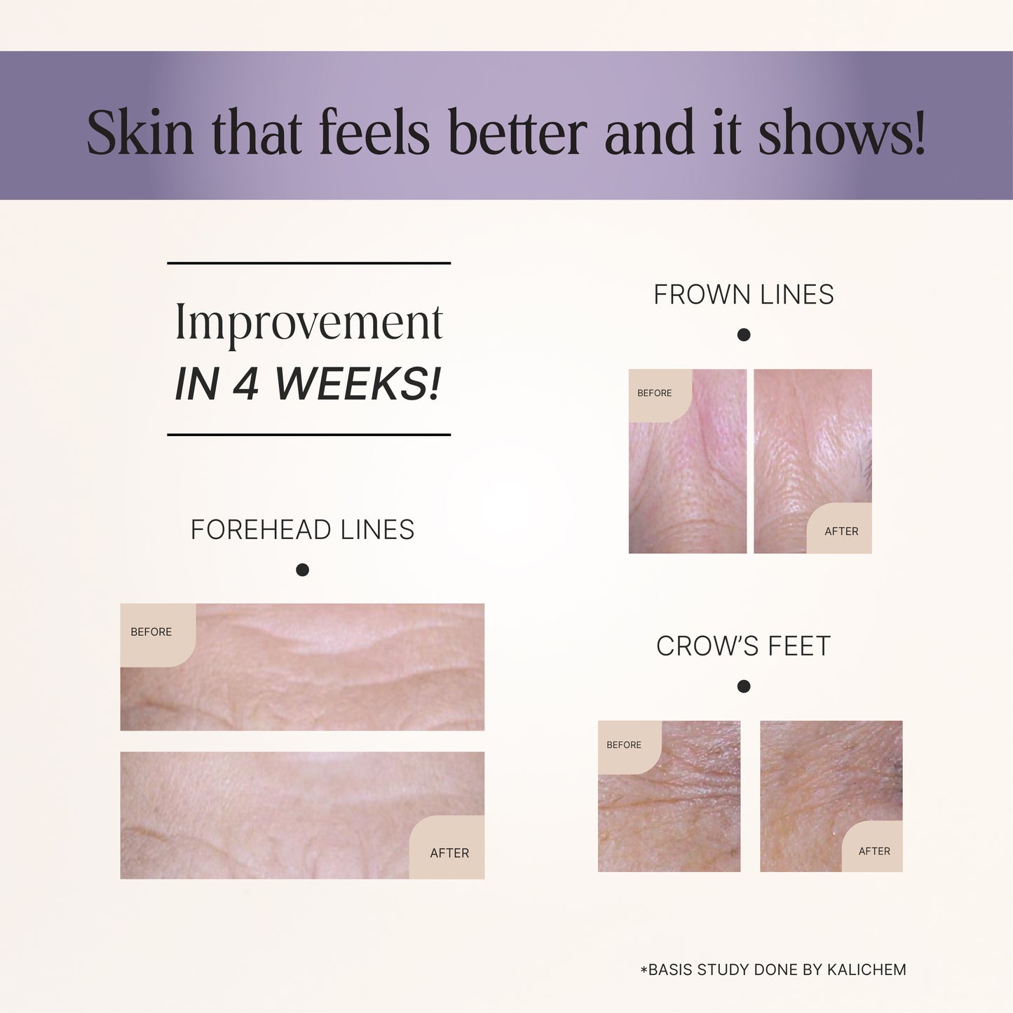 skin tightening serum