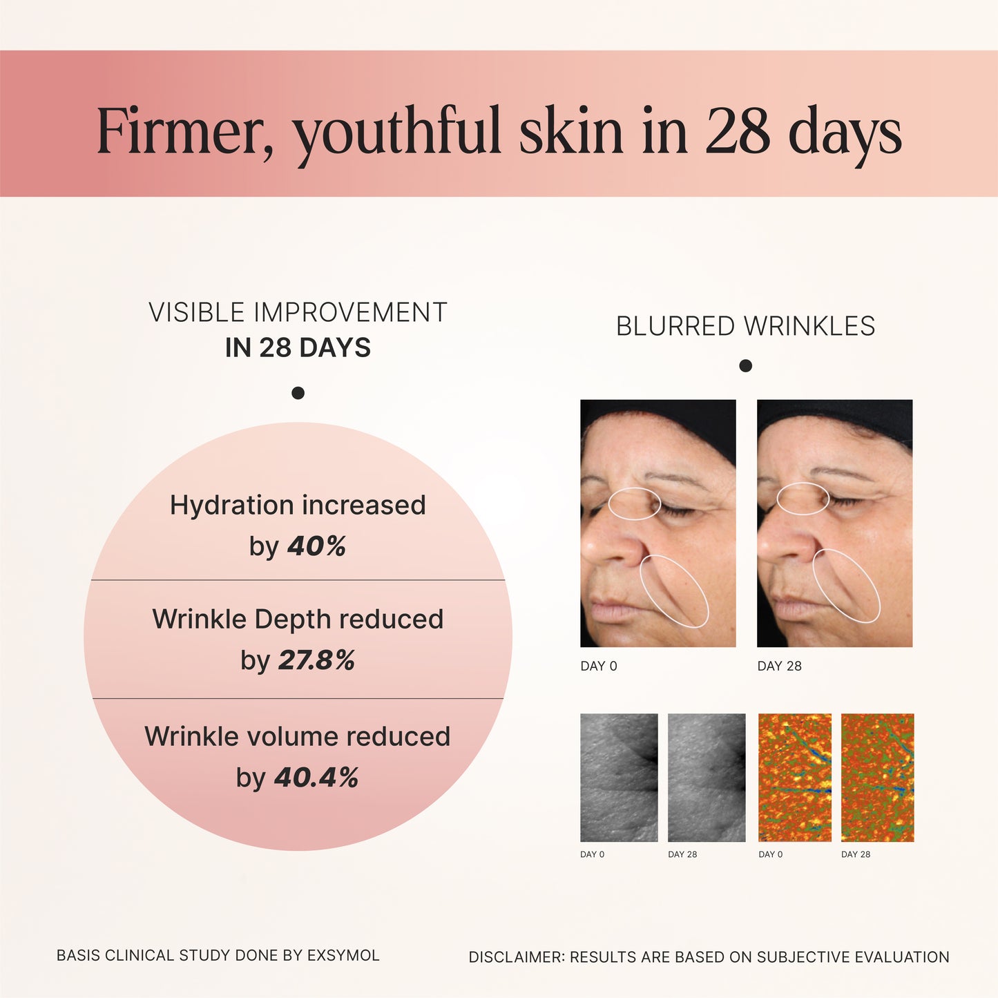 reduce wrinkles cream