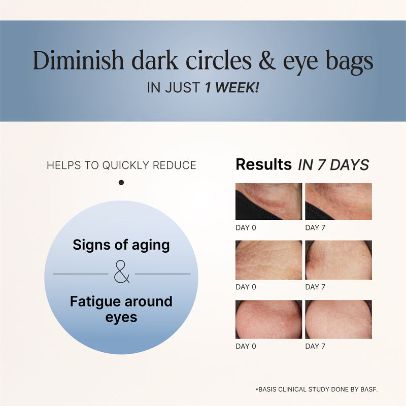 Time Travel Eye Serum (15ML) | With Sweet Orange And Brown Algae | Reduces Dark Circles And Puffiness