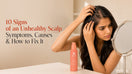10 Signs of an Unhealthy Scalp