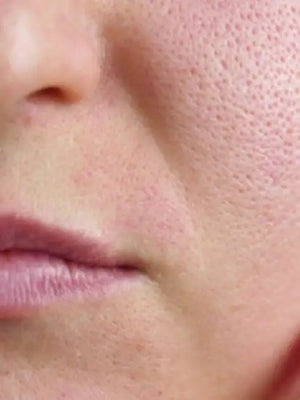 Pores/ Texture